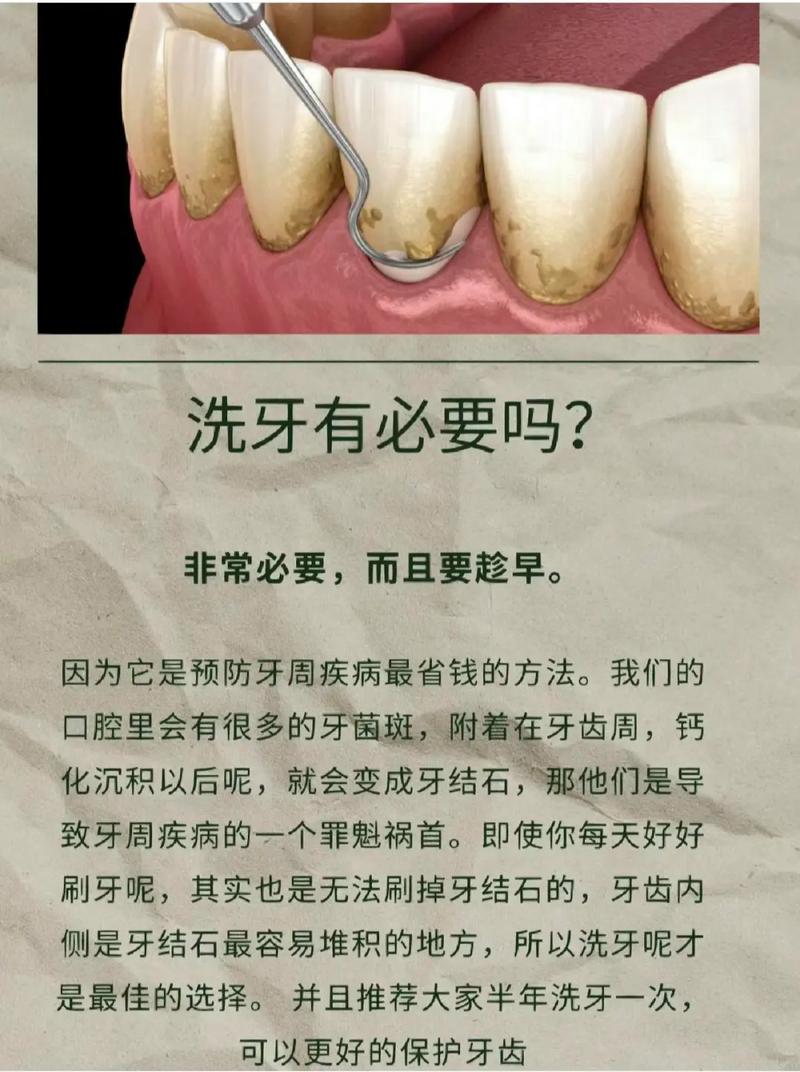 洗牙有什么利弊吗，你们洗过了多久，建不建议洗牙呢男子洗牙查出白血病视频牙龈易出血的人，能不能去洗牙呢？有何依据